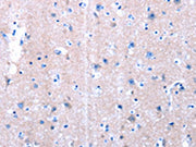 The image on the left is immunohistochemistry of paraffin-embedded Human brain tissue using CSB-PA140473(LAMA3 Antibody) at dilution 1/10, on the right is treated with synthetic peptide. (Original magnification: ×200)