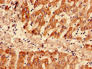 Immunohistochemistry analysis of human liver tissue using CSB-PA14047A0Rb at dilution of 1:100
