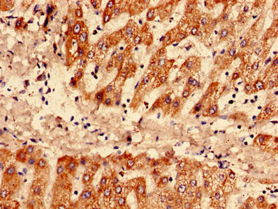 Immunohistochemistry analysis of human liver tissue using CSB-PA14047A0Rb at dilution of 1:100