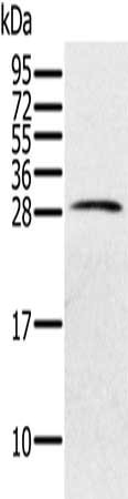 Gel: 12%SDS-PAGE, Lysate: 40 ug, Lane: Human testis tissue, Primary antibody: CSB-PA140660(PILRB Antibody) at dilution 1/200, Secondary antibody: Goat anti rabbit IgG at 1/8000 dilution, Exposure time: 40 seconds