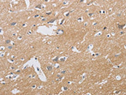 The image is immunohistochemistry of paraffin-embedded Human brain tissue using CSB-PA140706(KCNMB3 Antibody) at dilution 1/40. (Original magnification: ×200)