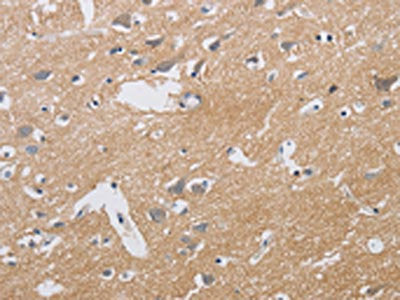 The image is immunohistochemistry of paraffin-embedded Human brain tissue using CSB-PA140706(KCNMB3 Antibody) at dilution 1/40. (Original magnification: ×200)