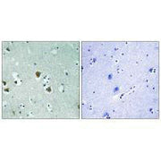 Immunohistochemistry analysis of paraffin-embedded human brain tissue using CRMP-2 (Ab-509) antibody.