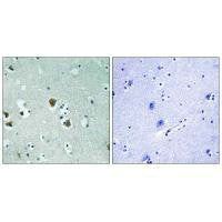 Immunohistochemistry analysis of paraffin-embedded human brain tissue using CRMP-2 (Ab-509) antibody.