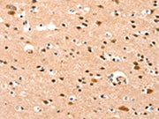 The image on the left is immunohistochemistry of paraffin-embedded Human brain tissue using CSB-PA140877(BAZ1A Antibody) at dilution 1/25, on the right is treated with synthetic peptide. (Original magnification: ×200)