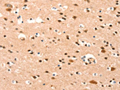 The image on the left is immunohistochemistry of paraffin-embedded Human brain tissue using CSB-PA140877(BAZ1A Antibody) at dilution 1/25, on the right is treated with synthetic peptide. (Original magnification: ×200)