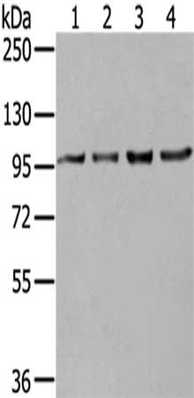 Gel: 6%SDS-PAGE,Lysate: 40 ug,Lane 1-4: K562 cells, 293T cells, 231 cells, Hela cells,Primary antibody: CSB-PA140909(NUP98 Antibody) at dilution 1/550 dilution,Secondary antibody: Goat anti rabbit IgG at 1/8000 dilution,Exposure time: 1 minute
