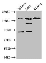 Western Blot Positive WB detected in: Mouse spleen tissue, Mouse lung tissue, Mouse kidney tissue All lanes: NOS1 antibody at 3ug/ml Secondary Goat polyclonal to rabbit IgG at 1/50000 dilution Predicted band size: 161, 149, 126, 44, 165 kDa Observ...