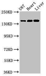 Western Blot Positive WB detected in: U87 whole cell lysate, Rat heart tissue, Mouse liver tissue All lanes: GRIN2A antibody at 3.2µg/ml Secondary Goat polyclonal to rabbit IgG at 1/50000 dilution Predicted band size: 166, 145 kDa Observed band si...