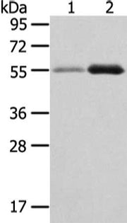 Gel: 8%SDS-PAGE, Lysate: 40 ug, Lane 1-2: Human normal stomach and thyroid cancer tissue, Primary antibody: CSB-PA141419(XKR3 Antibody) at dilution 1/330 dilution, Secondary antibody: Goat anti rabbit IgG at 1/8000 dilution, Exposure time: 2 minutes