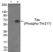 Western blot analysis of extracts from HepG2 cells (Lane 2), using Tau (Phospho-Thr217) Antibody. The lane on the left is treated with antigen-specific peptide.