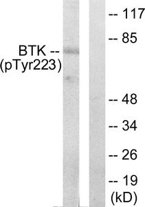 Western blot analysis of extracts from Hela cells treated with serum using BTK (phospho-Tyr223) Antibody.The lane on the right is treated with the antigen-specific peptide.