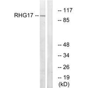 Western blot analysis of extracts from LOVO cells, using RHG17 antibody.