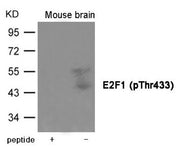 Western blot analysis of extracts from Mouse brain tissue using E2F1 (Phospho-Thr433) Antibody.The lane on the left is treated with the antigen-specific peptide.