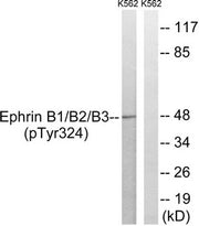 Western blot analysis of extracts from K562 cells treated with serum using Ephrin B1/B2/B3 (Phospho-Tyr324) Antibody.The lane on the right is treated with the antigen-specific peptide.