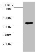 Western blot All lanes: MHT1 antibody at 2µg/ml + 293T whole cell lysate Secondary Goat polyclonal to rabbit IgG at 1/10000 dilution Predicted band size: 37 kDa Observed band size: 37 kDa