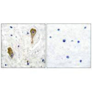 Immunohistochemical analysis of paraffin-embedded human brain tissue using GAD67 antibody.