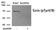 Western blot analysis of extracts from K562 cells treated with Na3VO4 using Phospho-Ezrin (Tyr478) antibody.The lane on the right is treated with the antigen-specific peptide.