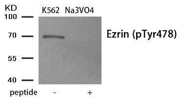 Western blot analysis of extracts from K562 cells treated with Na3VO4 using Phospho-Ezrin (Tyr478) antibody.The lane on the right is treated with the antigen-specific peptide.