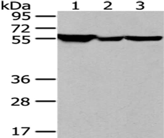 Gel: 8%SDS-PAGE, Lysate: 40 ug, Lane 1-3: Hela, K562 and NIH/3T3 cell, Primary antibody: CSB-PA143385(FYN Antibody) at dilution 1/200 dilution, Secondary antibody: Goat anti rabbit IgG at 1/8000 dilution, Exposure time: 30 seconds