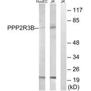 Western blot analysis of extracts from HuvEc cells and Jurkat cells, using PPP2R5D antibody.