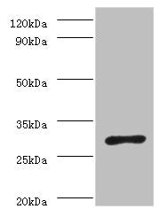 Western blot All lanes: ureA antibody at 2µg/ml + Helicobacter pylori bacteria liquid Secondary Goat polyclonal to rabbit IgG at 1/10000 dilution Predicted band size: 27 kDa Observed band size: 27 kDa