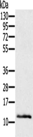 Gel: 12%SDS-PAGE, Lysate: 40 ug, Lane: Mouse skin tissue, Primary antibody: CSB-PA143897(Ly6a Antibody) at dilution 1/200, Secondary antibody: Goat anti rabbit IgG at 1/8000 dilution, Exposure time: 2 minutes