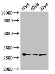 Western Blot Positive WB detected in: Arabidopsis thaliana lysate at 80µg, 40µg, 20µg All lanes: APX2 antibody; HRP conjugated at 0.6µg/ml Predicted band size: 29 kDa Observed band size: 29 kDa