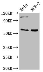 Western Blot Positive WB detected in: Hela whole cell lysate, MCF-7 whole cell lysate All lanes: RUNX2 antibody at 3ug/ml Secondary Goat polyclonal to rabbit IgG at 1/50000 dilution Predicted band size: 57, 56, 55 kDa Observed band size: 57 kDa