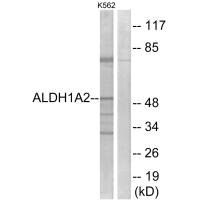Western blot analysis of extracts from K562 cells, using ALDH1A2 antibody.