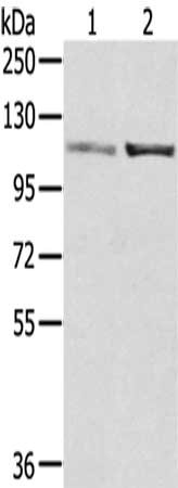 Gel: 6%SDS-PAGE,Lysate: 40 ug,Lane 1-2: A172 cells, 231 cells,Primary antibody: CSB-PA144641(SENP7 Antibody) at dilution 1/800 dilution,Secondary antibody: Goat anti rabbit IgG at 1/8000 dilution,Exposure time: 30 seconds