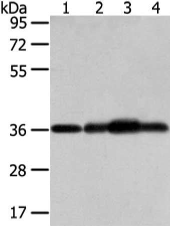 Gel: 8%SDS-PAGE, Lysate: 40 ug, Lane 1-4: Mouse brain tissue, hepg2, 293T and 231 cell, Primary antibody: CSB-PA144649(STX12 Antibody) at dilution 1/800 dilution, Secondary antibody: Goat anti rabbit IgG at 1/8000 dilution, Exposure time: 5 seconds