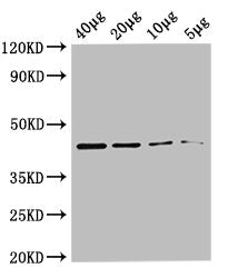 Western Blot Positive WB detected in: Rosseta bacteria lysate at 40µg, 20µg, 10µg, 5µg All lanes: metC antibody at 0.36µg/ml Secondary Goat polyclonal to rabbit IgG at 1/50000 dilution Predicted band size: 44 kDa Observed band size: 44 kDa