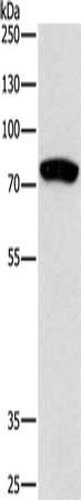 Gel: 10%SDS-PAGE, Lysate: 40 ug, Lane: Human fetal liver tissue, Primary antibody: CSB-PA144857(PRKCB Antibody) at dilution 1/170, Secondary antibody: Goat anti rabbit IgG at 1/8000 dilution, Exposure time: 3 minutes