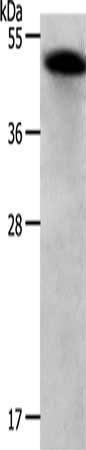 Gel: 12%SDS-PAGE, Lysate: 30 ug, Lane: Human liver cancer tissue, Primary antibody: CSB-PA145037(RBMS1 Antibody) at dilution 1/300, Secondary antibody: Goat anti rabbit IgG at 1/8000 dilution, Exposure time: 20 seconds