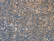 The image on the left is immunohistochemistry of paraffin-embedded Human tonsil tissue using CSB-PA145330(FXYD1 Antibody) at dilution 1/60, on the right is treated with fusion protein. (Original magnification: ×200)