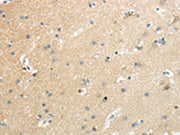 The image on the left is immunohistochemistry of paraffin-embedded Human brain tissue using CSB-PA145393(SLC7A11 Antibody) at dilution 1/35, on the right is treated with synthetic peptide. (Original magnification: ×200)
