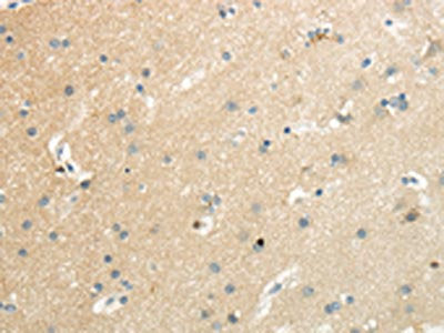 The image on the left is immunohistochemistry of paraffin-embedded Human brain tissue using CSB-PA145393(SLC7A11 Antibody) at dilution 1/35, on the right is treated with synthetic peptide. (Original magnification: ×200)