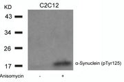 Western blot analysis of extracts from C2C12 cells untreated or treated with Anisomycin using a-Synuclein(Phospho-Tyr125) Antibody.