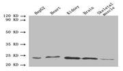 Western blot All lanes: ORM2 antibody at 1.6µg/ml Lane 1: HepG2 whole cell lysate Lane 2: Mouse heart tissue Lane 3: Mouse kidney tissue Lane 4: Mouse brain tissue Lane 5: Mouse skeletal muscle tissue Secondary Goat polyclonal to rabbit IgG at 1/1...