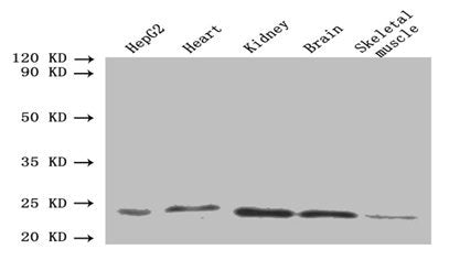 Western blot All lanes: ORM2 antibody at 1.6µg/ml Lane 1: HepG2 whole cell lysate Lane 2: Mouse heart tissue Lane 3: Mouse kidney tissue Lane 4: Mouse brain tissue Lane 5: Mouse skeletal muscle tissue Secondary Goat polyclonal to rabbit IgG at 1/1...