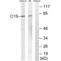 Western blot analysis of extracts from Jurkat cells and COLO cells, using C1S antibody.