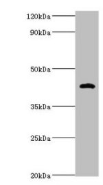 Western blot All lanes: HP antibody at 2µg/ml + Mouse stomach tissue Secondary Goat polyclonal to rabbit IgG at 1/10000 dilution Predicted band size: 46, 39 kDa Observed band size: 46 kDa