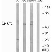 Western blot analysis of extracts from Jurkat cells, A549 cells and COLO cells, using CHST2 antibody.