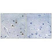 Immunohistochemistry analysis of paraffin-embedded human brain tissue, using ARRDC2 antibody.