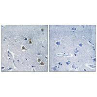 Immunohistochemistry analysis of paraffin-embedded human brain tissue, using ARRDC2 antibody.