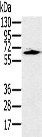 Gel: 12%SDS-PAGE, Lysate: 40 ug, Lane: 231 cells, Primary antibody: CSB-PA146443(HSF2 Antibody) at dilution 1/400, Secondary antibody: Goat anti rabbit IgG at 1/8000 dilution, Exposure time: 5 minutes