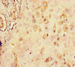 Immunohistochemistry of paraffin-embedded human placenta tissue using CSB-PA14659A0Rb at dilution of 1:100