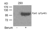 Western blot analysis of extracts from 293 cells untreated or treated with Serum using Pyk2(Phospho-Tyr402) Antibody.