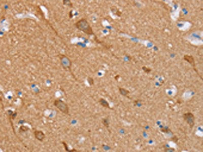 The image on the left is immunohistochemistry of paraffin-embedded Human brain tissue using CSB-PA147125(STMN1 Antibody) at dilution 1/20, on the right is treated with synthetic peptide. (Original magnification: ×200)